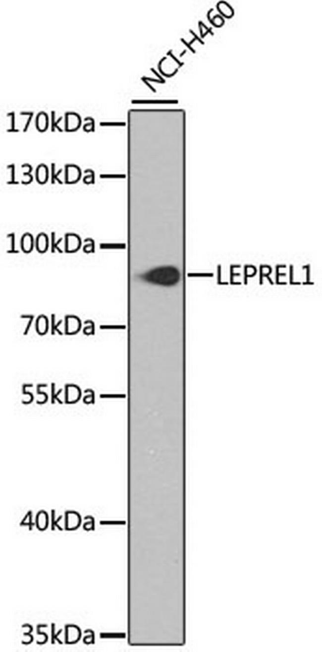 LEPREL1 Antibody in Western Blot (WB)