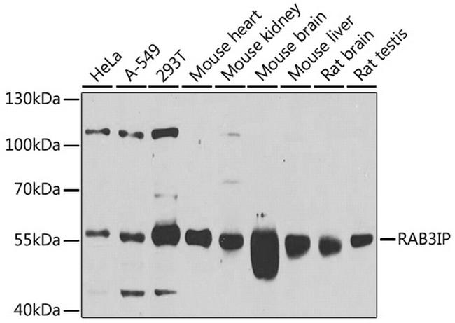 RAB3IP Antibody in Western Blot (WB)