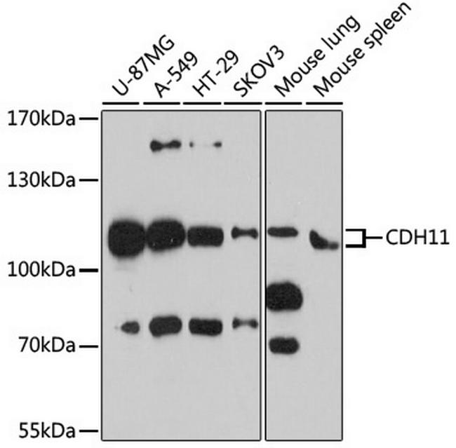 CDH11 Antibody in Western Blot (WB)