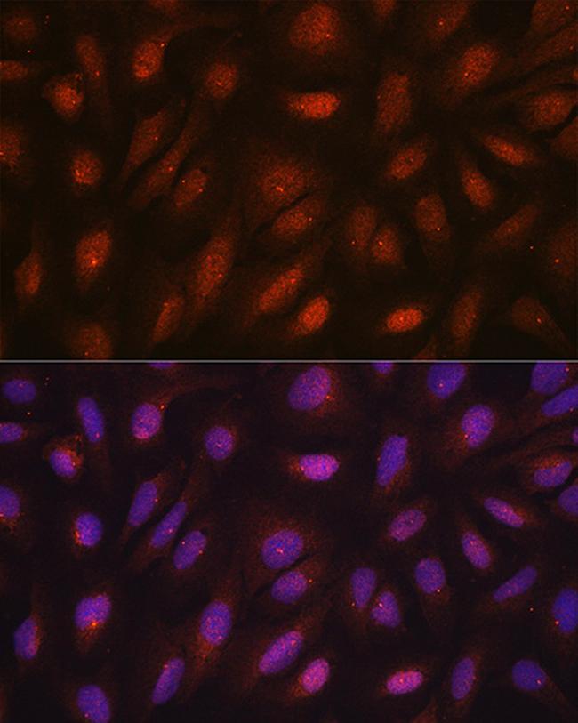 Centrin 3 Antibody in Immunocytochemistry (ICC/IF)