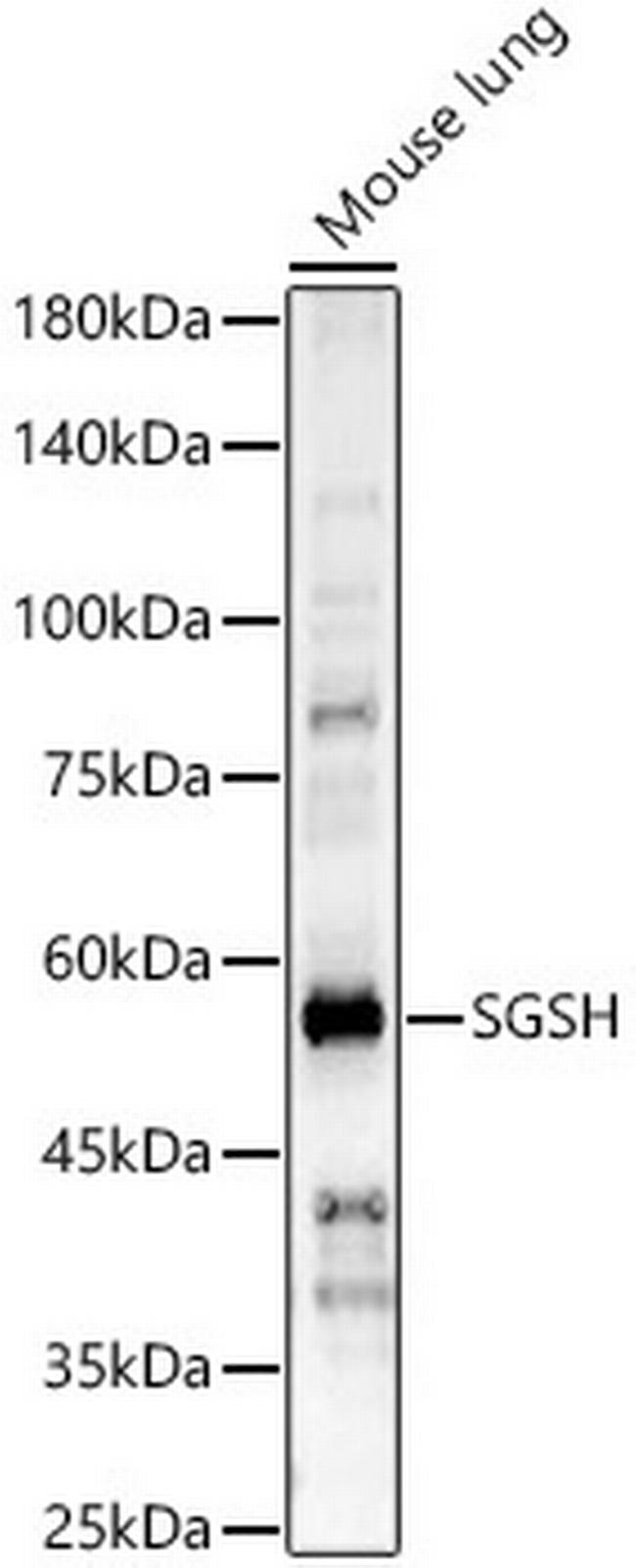 SGSH Antibody in Western Blot (WB)