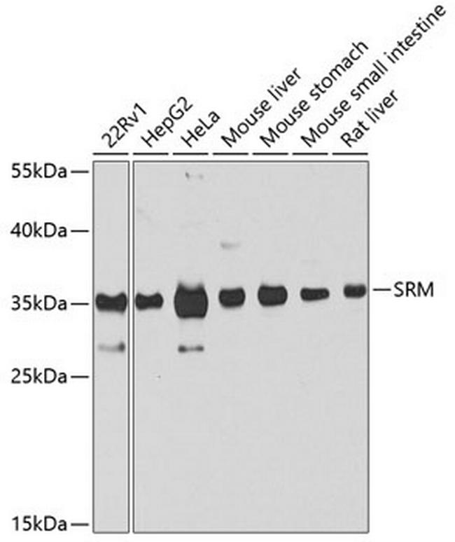 SRM Antibody in Western Blot (WB)