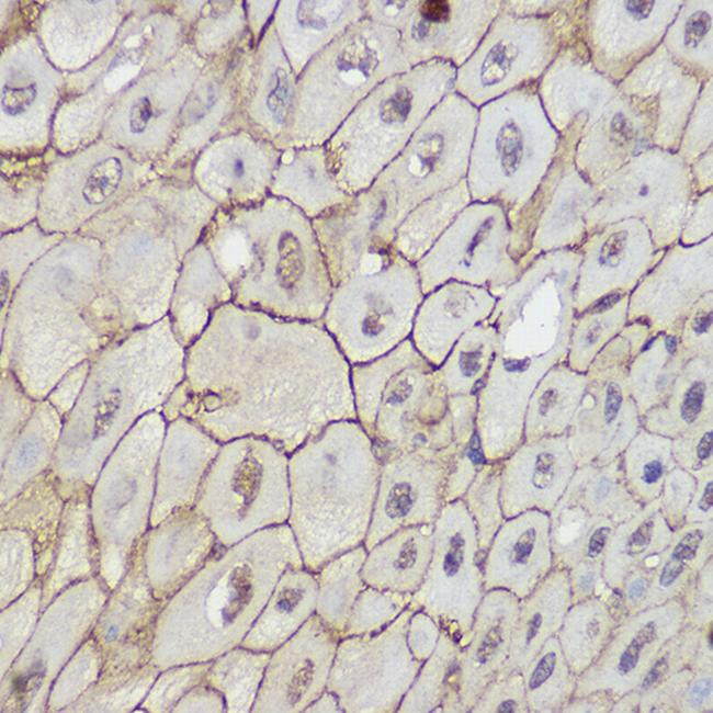 TRPC6 Antibody in Immunohistochemistry (Paraffin) (IHC (P))