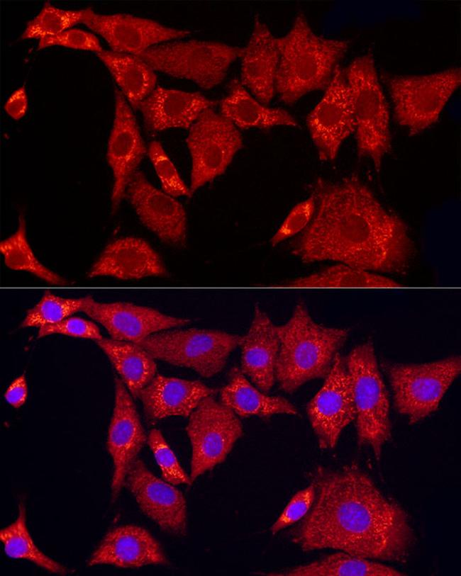 SLC25A11 Antibody in Immunocytochemistry (ICC/IF)