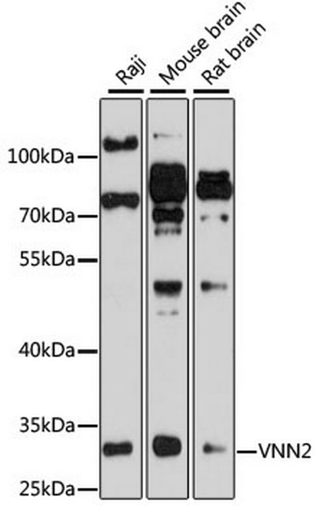 VNN2 Antibody in Western Blot (WB)