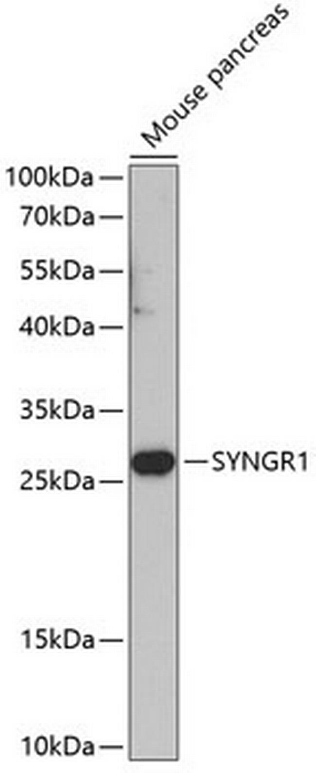 SYNGR1 Antibody in Western Blot (WB)