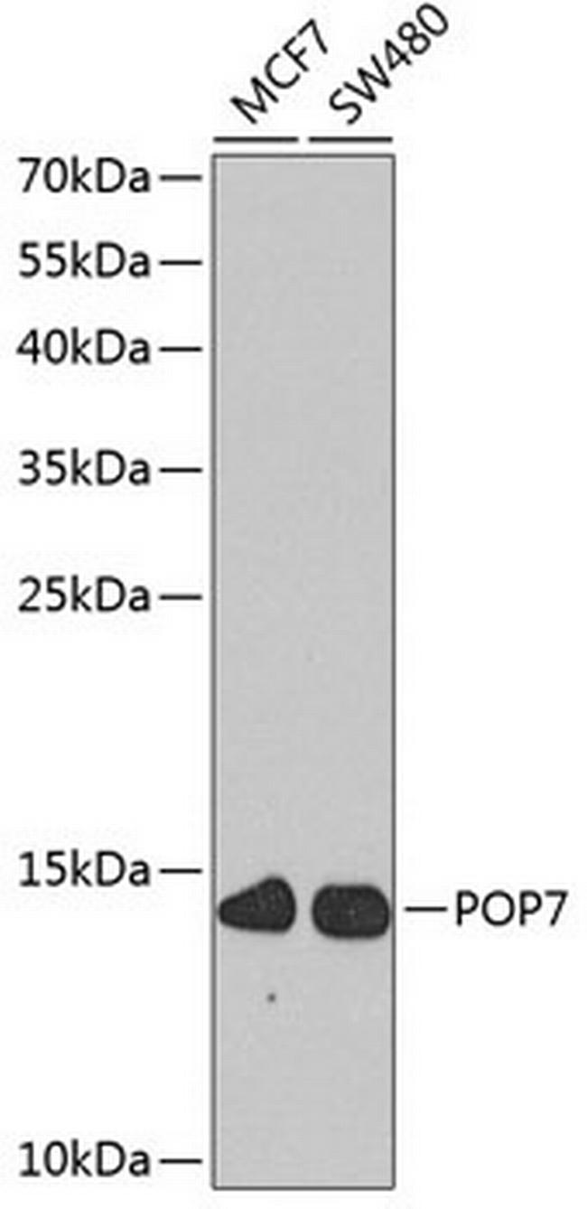 POP7 Antibody in Western Blot (WB)