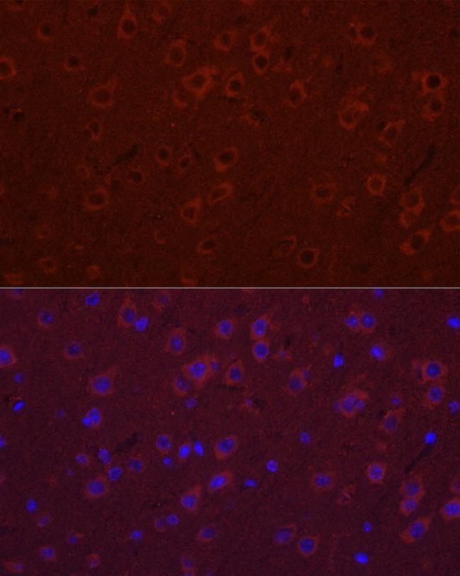 SYT11 Antibody in Immunocytochemistry (ICC/IF)