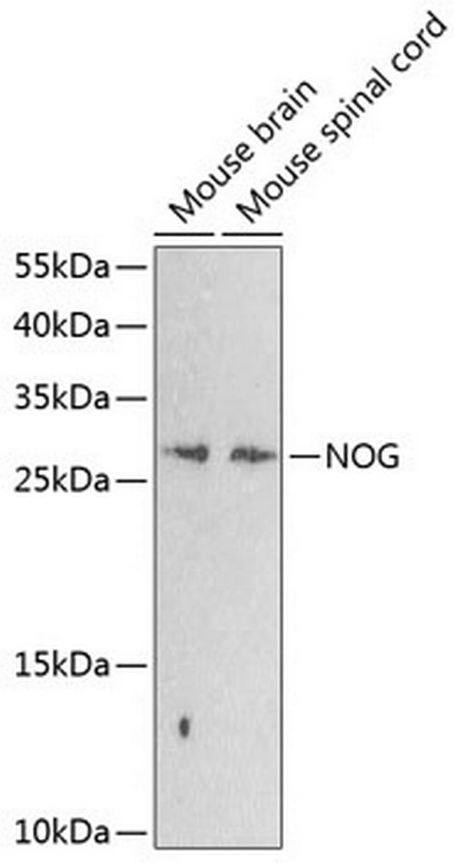 Noggin Antibody in Western Blot (WB)