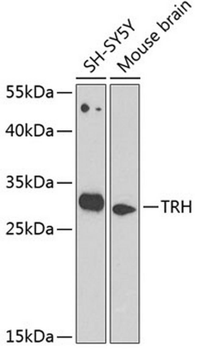 TRH Antibody in Western Blot (WB)