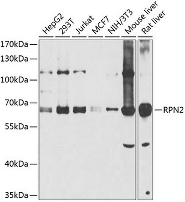 Ribophorin II Antibody in Western Blot (WB)