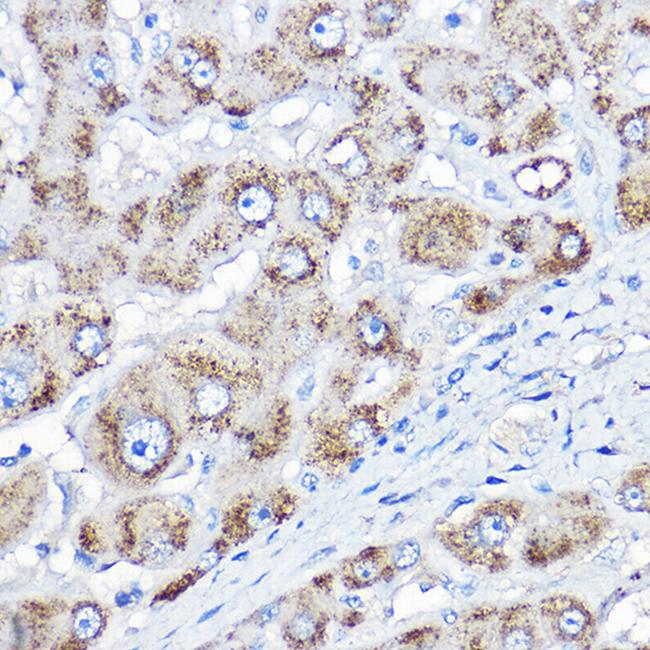 AGXT Antibody in Immunohistochemistry (Paraffin) (IHC (P))