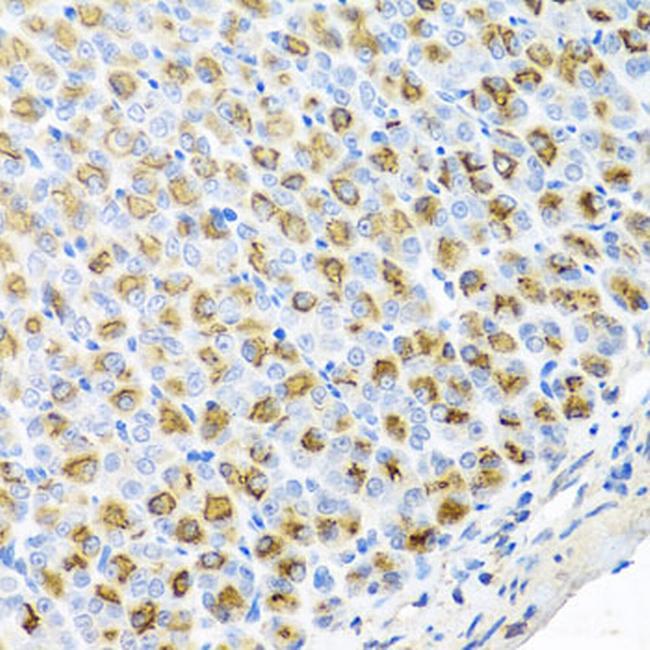 FECH Antibody in Immunohistochemistry (Paraffin) (IHC (P))