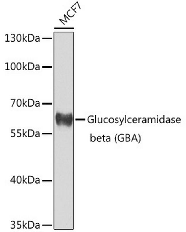 GBA Antibody in Western Blot (WB)