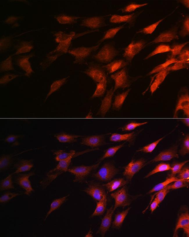 NF-H Antibody in Immunocytochemistry (ICC/IF)