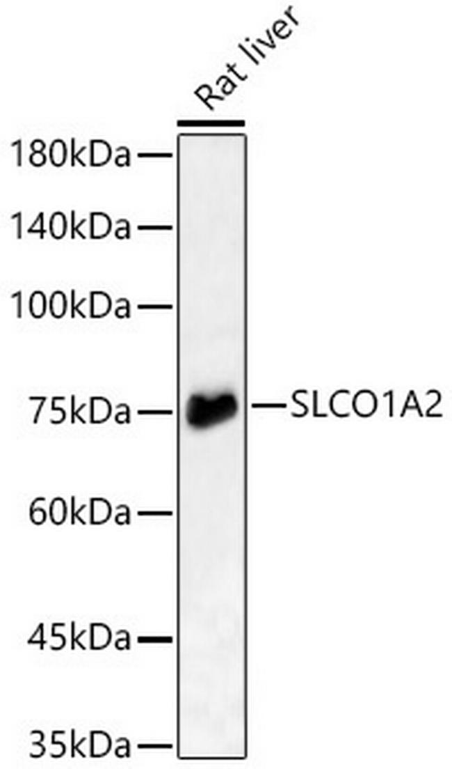 OATP1 Antibody in Western Blot (WB)