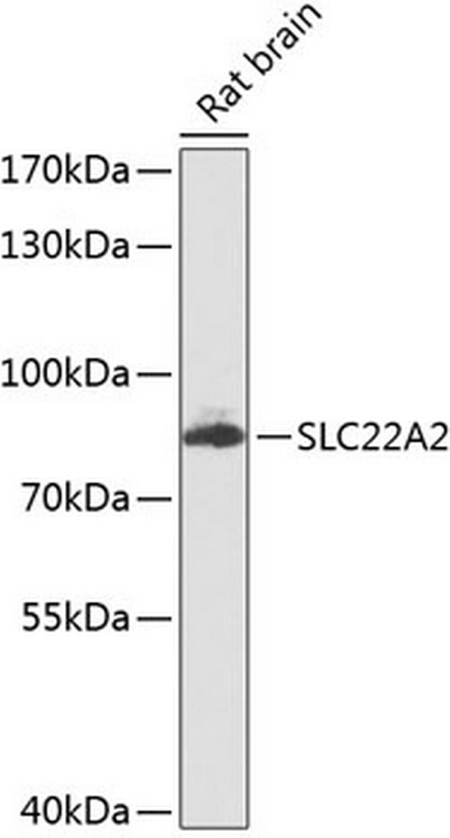 SLC22A2 Antibody in Western Blot (WB)