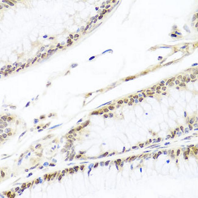 HIRA Antibody in Immunohistochemistry (Paraffin) (IHC (P))