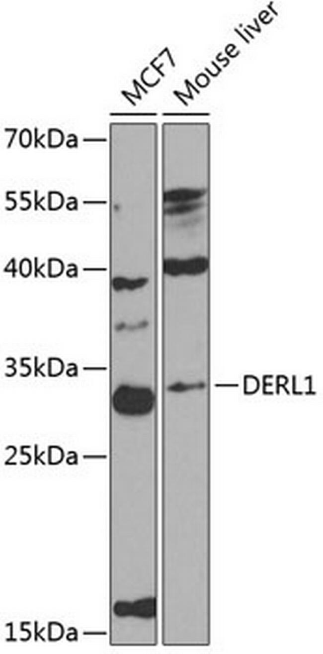 DERL1 Antibody in Western Blot (WB)