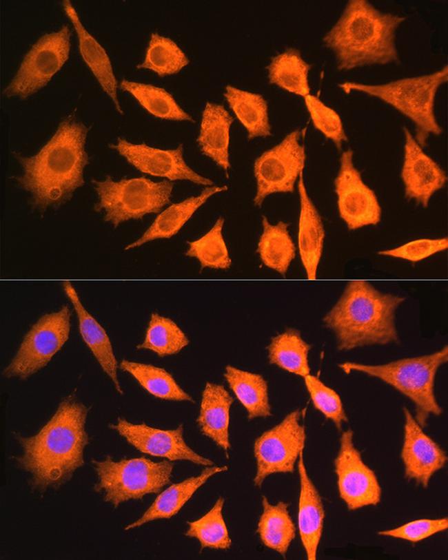 CKAP5 Antibody in Immunocytochemistry (ICC/IF)