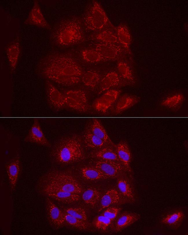 FCGRT Antibody in Immunocytochemistry (ICC/IF)