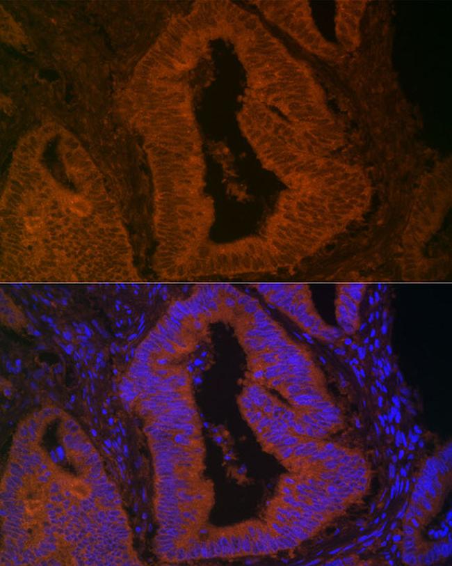 MYO5B Antibody in Immunohistochemistry (Paraffin) (IHC (P))