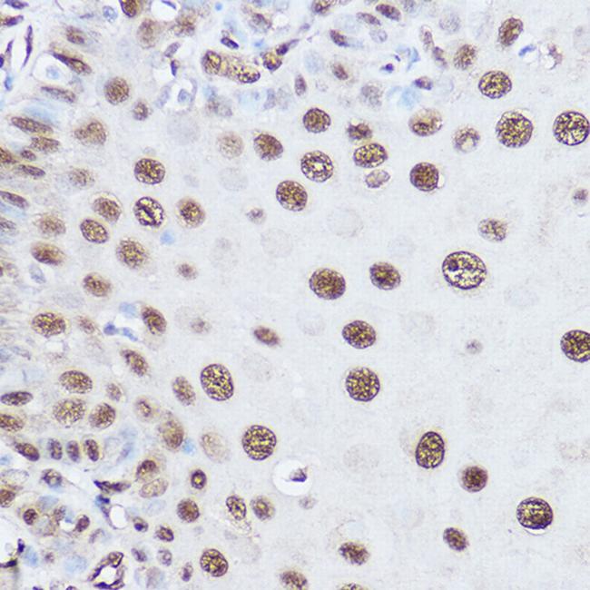 SART1 Antibody in Immunohistochemistry (Paraffin) (IHC (P))