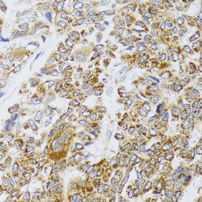 AIFM3 Antibody in Immunohistochemistry (Paraffin) (IHC (P))