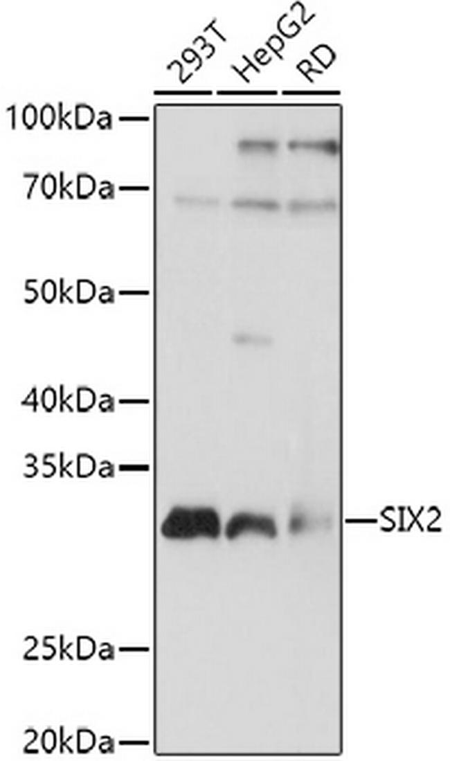 SIX2 Antibody in Western Blot (WB)