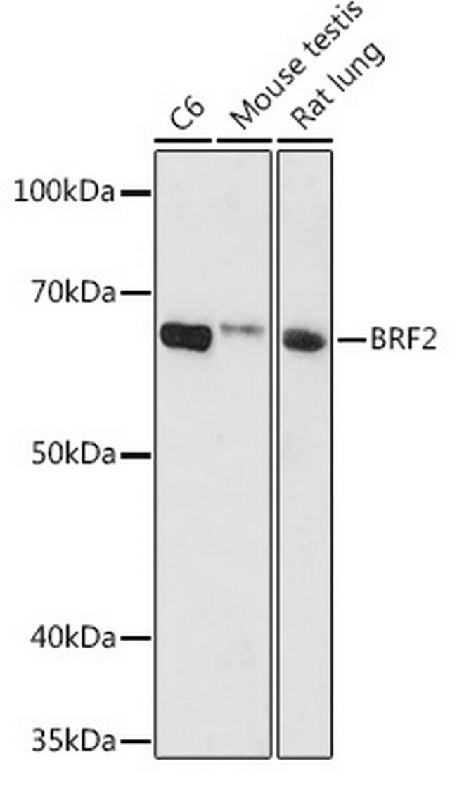 BRF2 Antibody in Western Blot (WB)