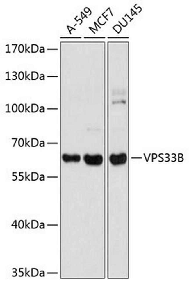 VPS33B Antibody in Western Blot (WB)