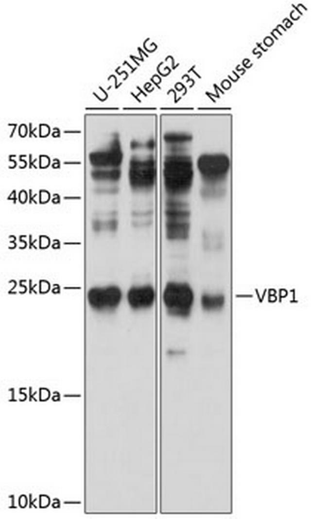 VBP1 Antibody in Western Blot (WB)