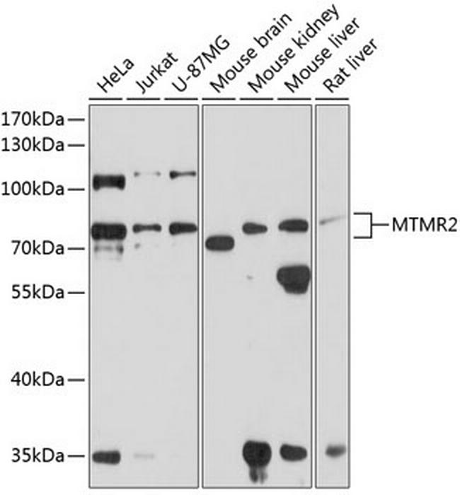 MTMR2 Antibody in Western Blot (WB)