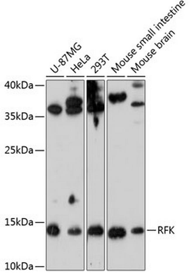 RFK Antibody in Western Blot (WB)