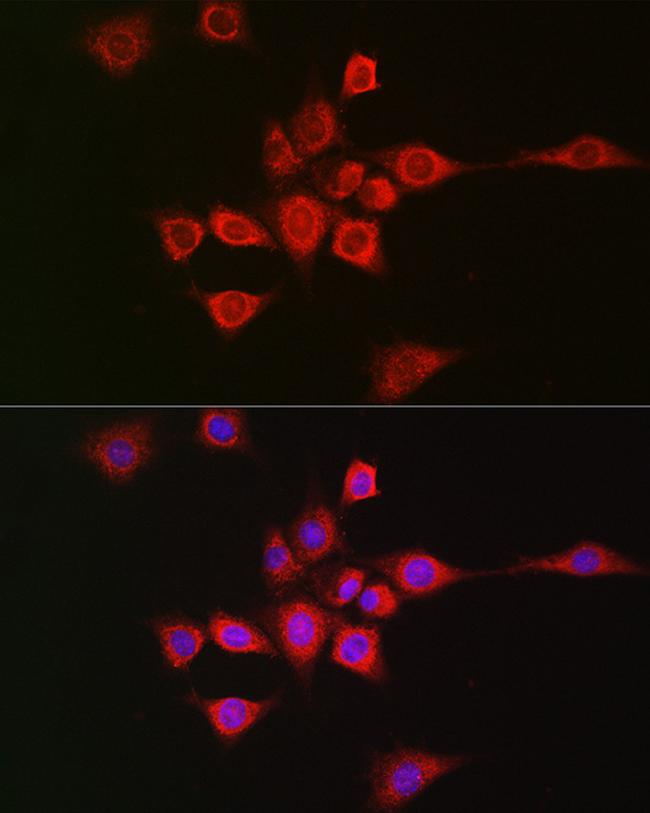 METTL4 Antibody in Immunocytochemistry (ICC/IF)