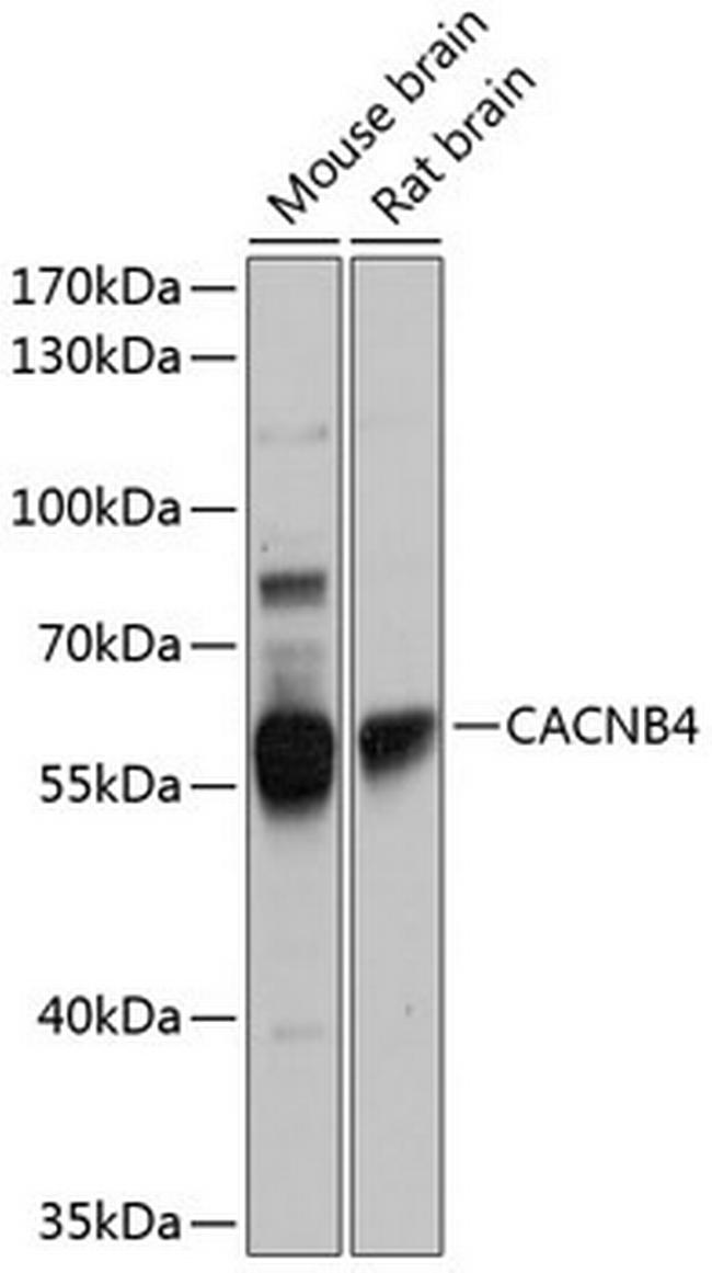 Calcium Channel beta-4 Antibody in Western Blot (WB)