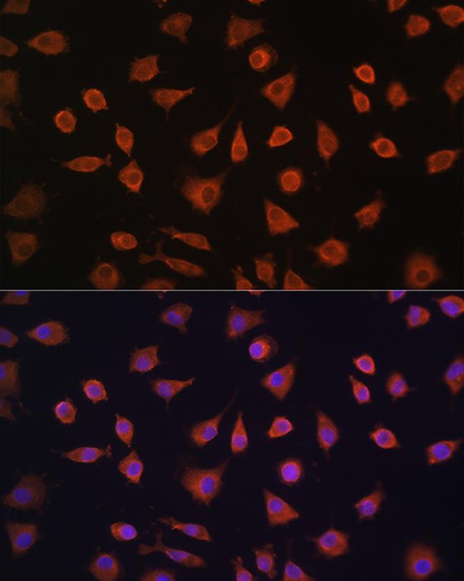 PFKFB2 Antibody in Immunocytochemistry (ICC/IF)