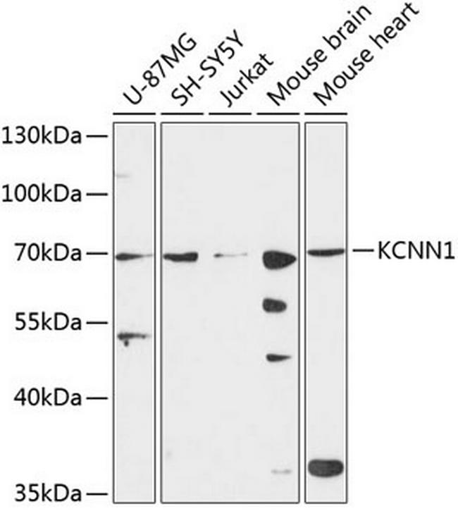 KCNN1 Antibody in Western Blot (WB)