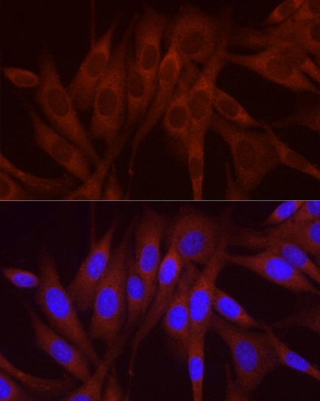 NUMB Antibody in Immunocytochemistry (ICC/IF)