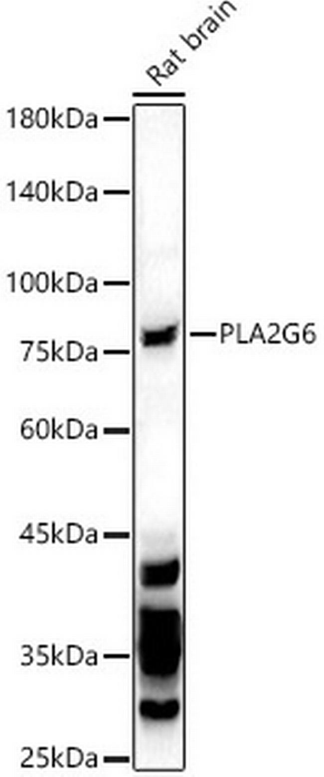 PLA2G6 Antibody in Western Blot (WB)