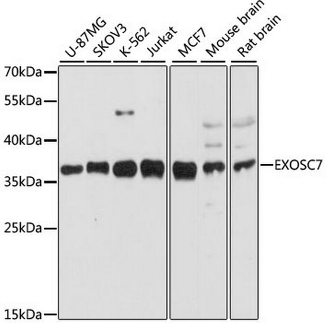 EXOSC7 Antibody in Western Blot (WB)