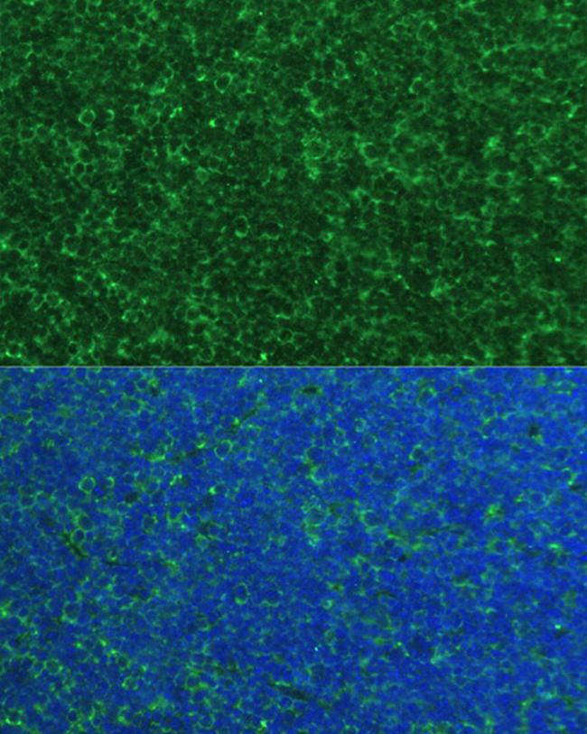 NOXA Antibody in Immunocytochemistry (ICC/IF)