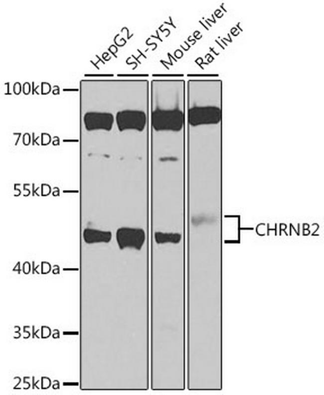 CHRNB2 Antibody in Western Blot (WB)