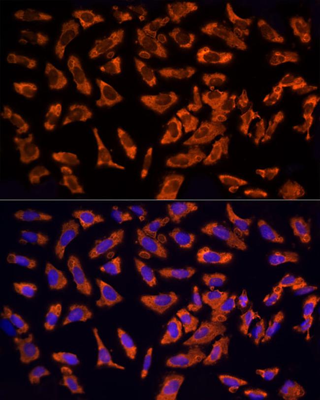 EPS15 Antibody in Immunocytochemistry (ICC/IF)