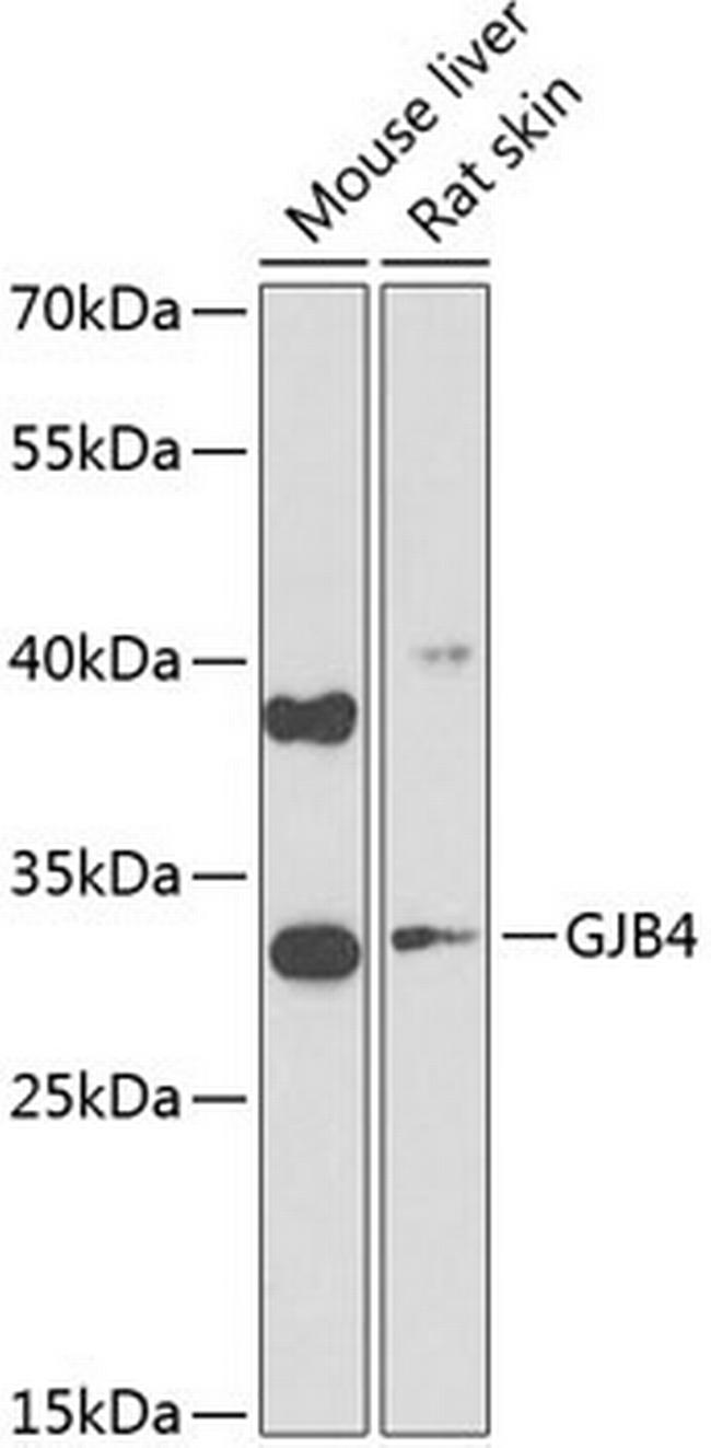 Connexin 30.3 Antibody in Western Blot (WB)