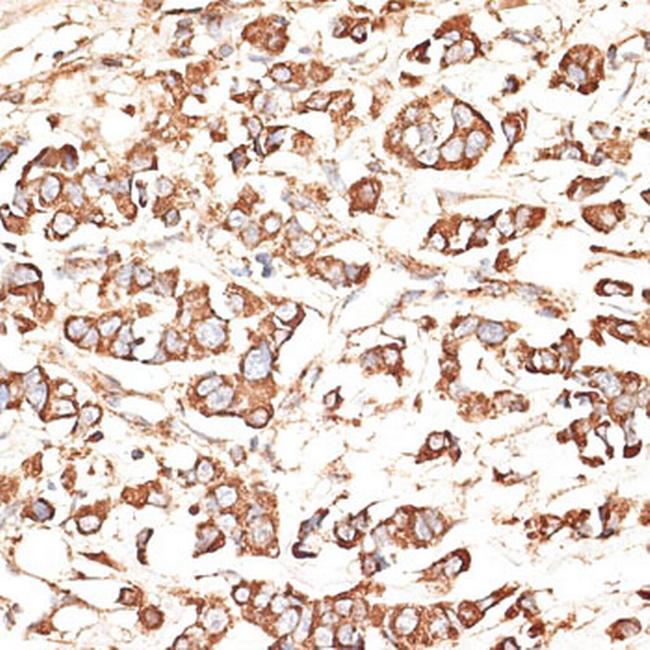 KIR3DS1 Antibody in Immunohistochemistry (Paraffin) (IHC (P))