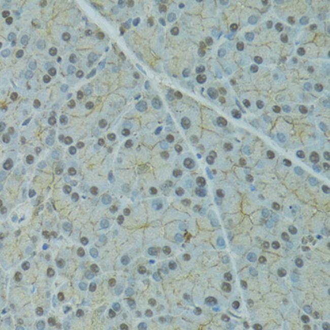 SERPINF2 Antibody in Immunohistochemistry (Paraffin) (IHC (P))