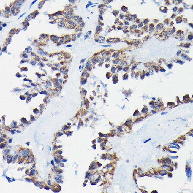 RGS14 Antibody in Immunohistochemistry (Paraffin) (IHC (P))