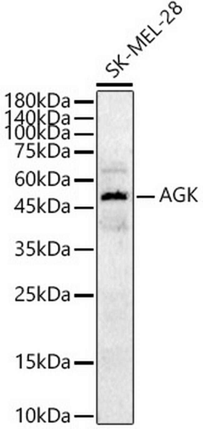 AGK Antibody in Western Blot (WB)