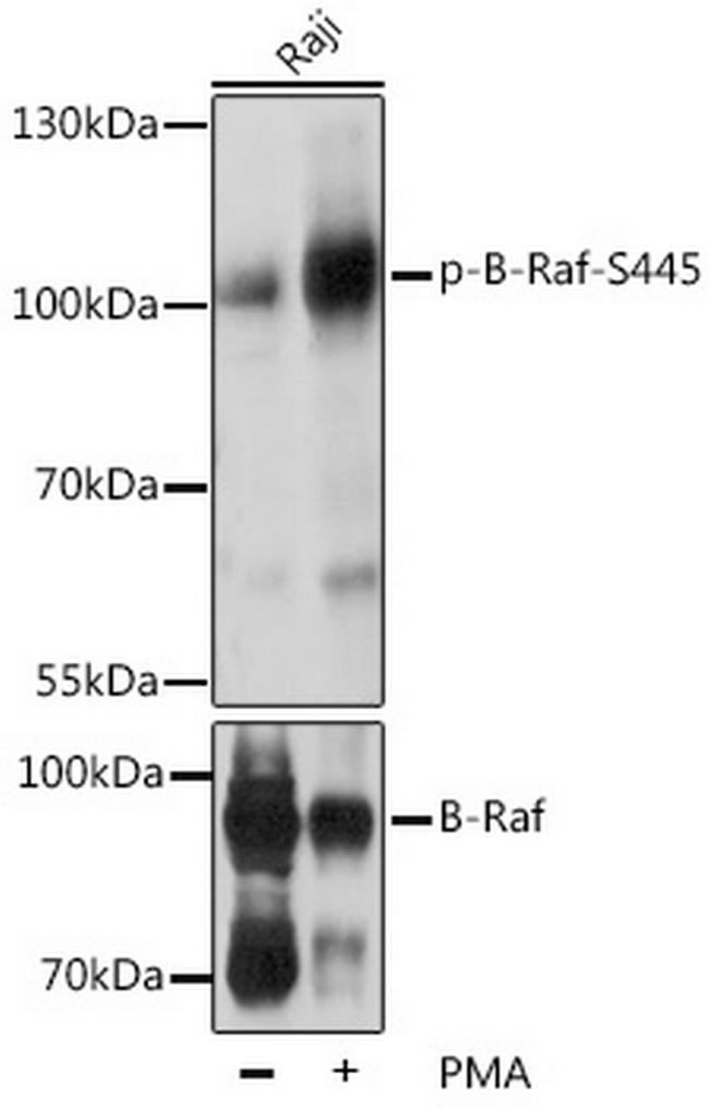 Phospho-B-Raf (Ser445) Antibody in Western Blot (WB)